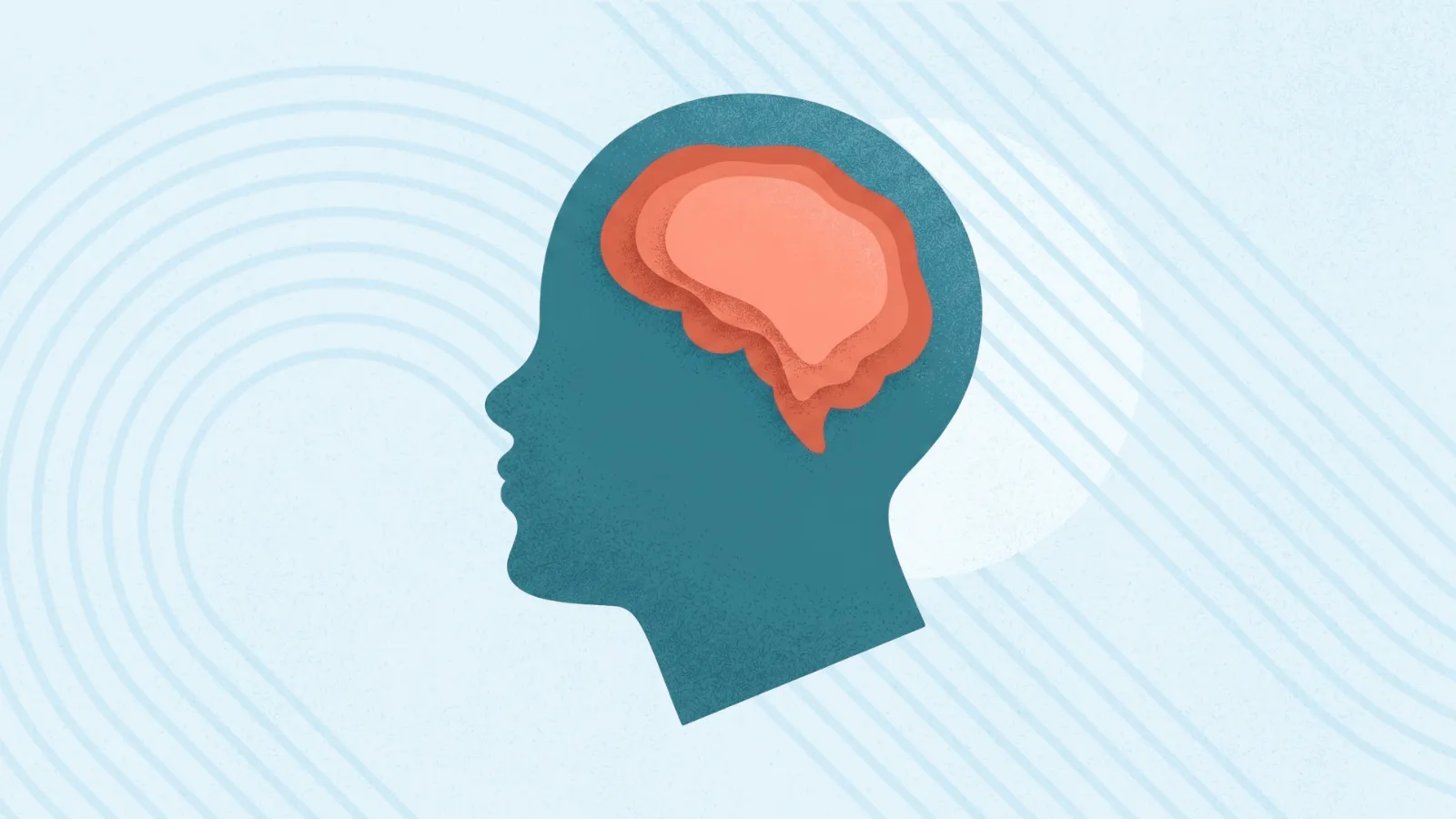 Stages of Alzheimer's Disease Essential Guide for Care Providers